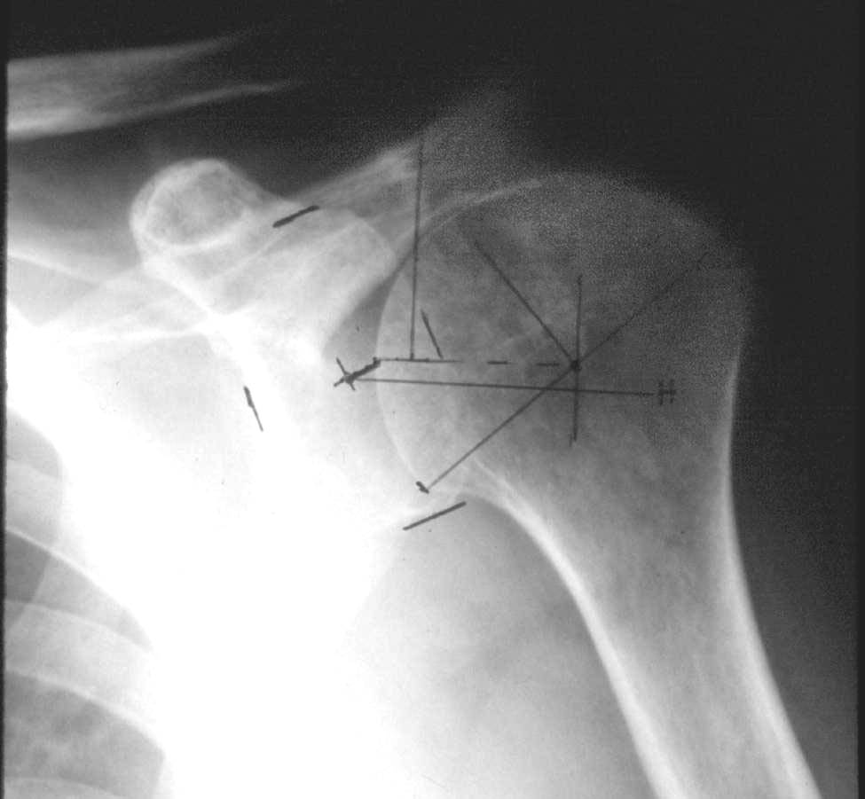 x-ray
